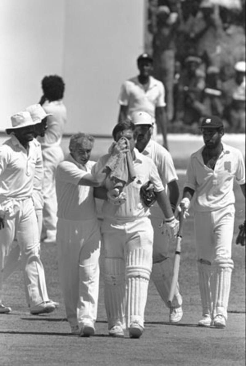 Mike Gatting of England leaves the field with a broken nose after being hit by the ball during the first test against the West Indies in Jamacia in 1986 &copy; Getty Images