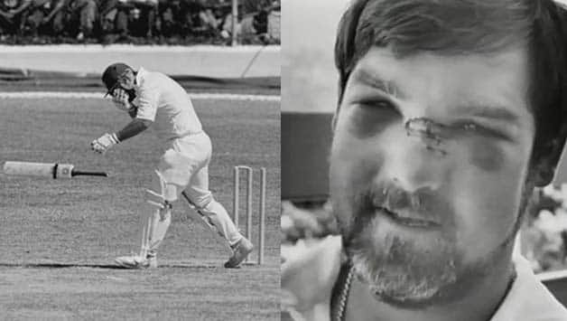 Head And Face Injuries In Cricket — Part 2 Of 3 Cricket Country