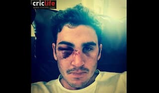 Eye injury to keep Craig Kieswetter out of cricket in 2015