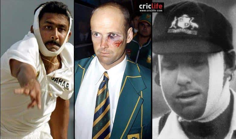 10 cricketers who braved debilitating injuries and played courageously