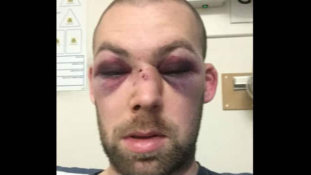 Alex Tait will require a number of invasive operations from ear to ear © JustGiving.com