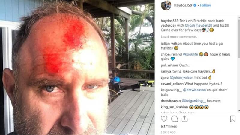 Matthew Hayden Injury